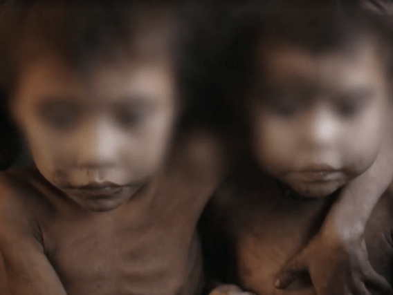 Menina Yanomami protege irmã Menina Yanomami protege irmã